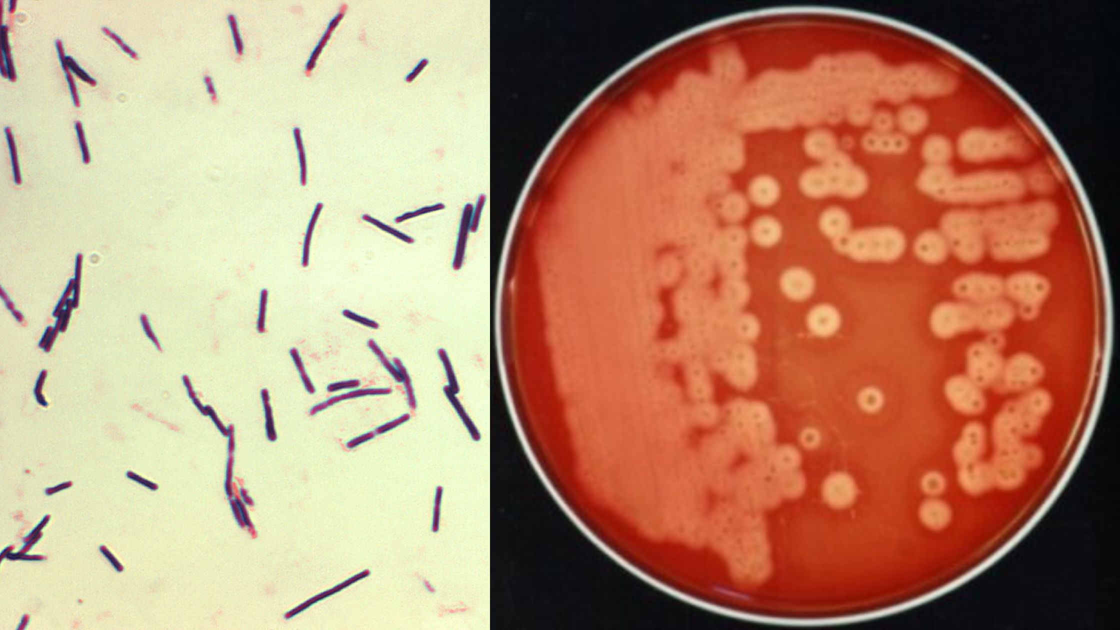 Clostridium perfringens 