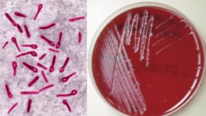 Clostridium tetani – Overview
