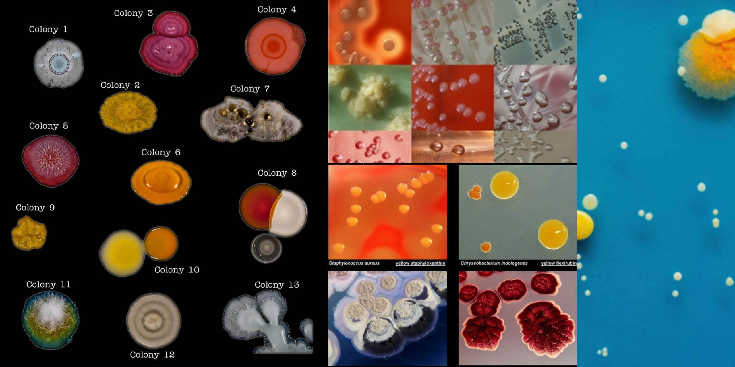 Colony Morphology of Bacteria and Examples