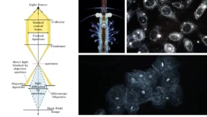 Dark Field Microscopy – Principle, Parts, Procedure, Uses