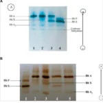 Cellulose Acetate Electrophoresis - Definition, Principle, Operating Procedure, Uses