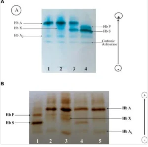 Cellulose Acetate Electrophoresis – Definition, Principle, Operating Procedure, Uses