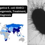 Enteroaggregative E. coli (EAEC) - Disease, Pathogenesis, Treatment, Diagnosis