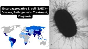 Enteroaggregative E. coli (EAEC) – Disease, Pathogenesis, Treatment, Diagnosis