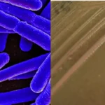 Enteroinvasive E. coli (EIEC) - Transmission, Disease, Pathogenesis, Treatment