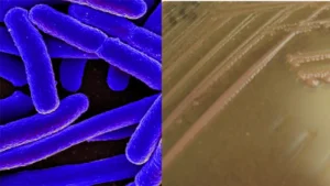 Enteroinvasive E. coli (EIEC) – Transmission, Disease, Pathogenesis, Treatment