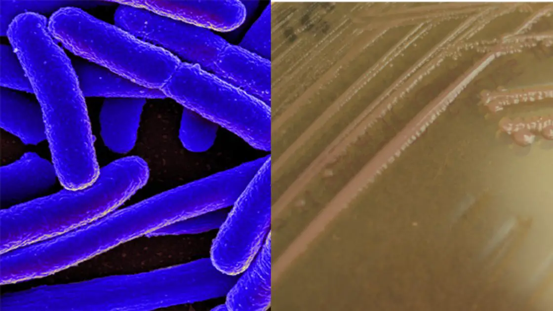 Enteroinvasive E. coli (EIEC) - Transmission, Disease, Pathogenesis, Treatment