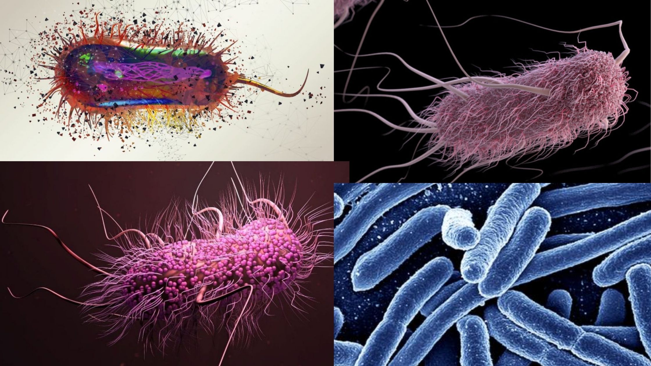 Escherichia coli(E. coli) morphology, arrangement, Cultural Characteristics, Diagnosis