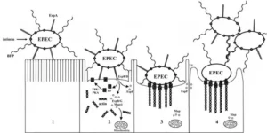 Enteropathogenic Escherichia coli (EPEC) – Diseases, Toxins, Mode of Actions, Transmission