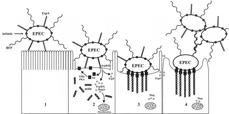 Enteropathogenic Escherichia coli (EPEC) - Diseases, Toxins, Mode of Actions, Transmission