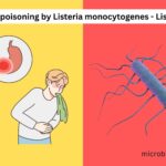 Food poisoning by Listeria monocytogenes - Listeriosis