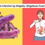 Foodborne Infection by Shigella- Shigellosis Food Poisoning