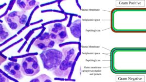Gram Positive bacteria – Definition, Structure, Characteristics, Examples
