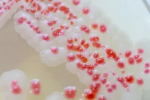 Serratia marcescens – Overview