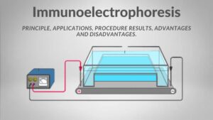 Immunoelectrophoresis – Principle, Applications, Procedure, Results, Advantages and Disadvantages.