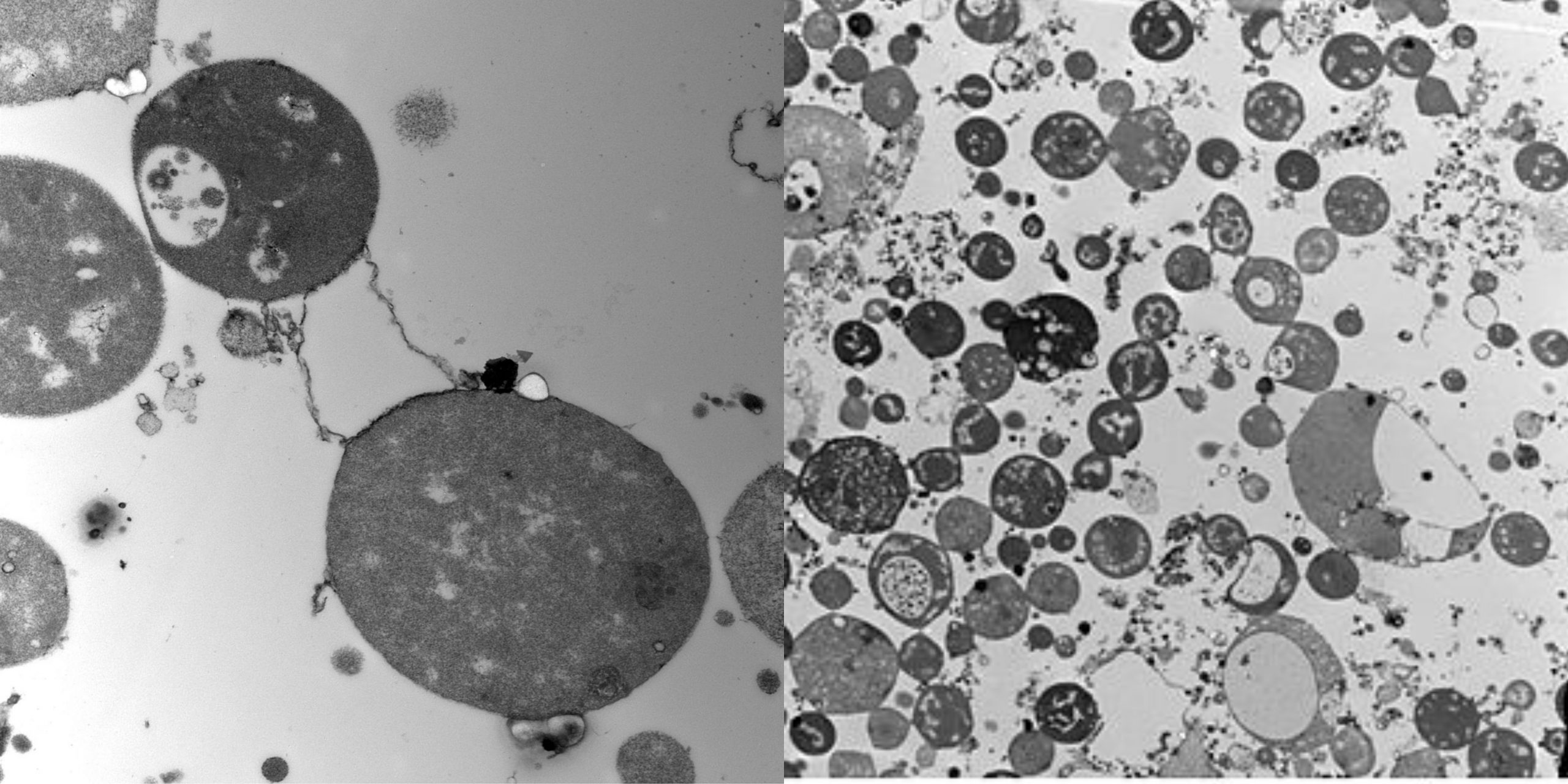 L-form bacteria - Definition, Size and shape, Culturing , Applications