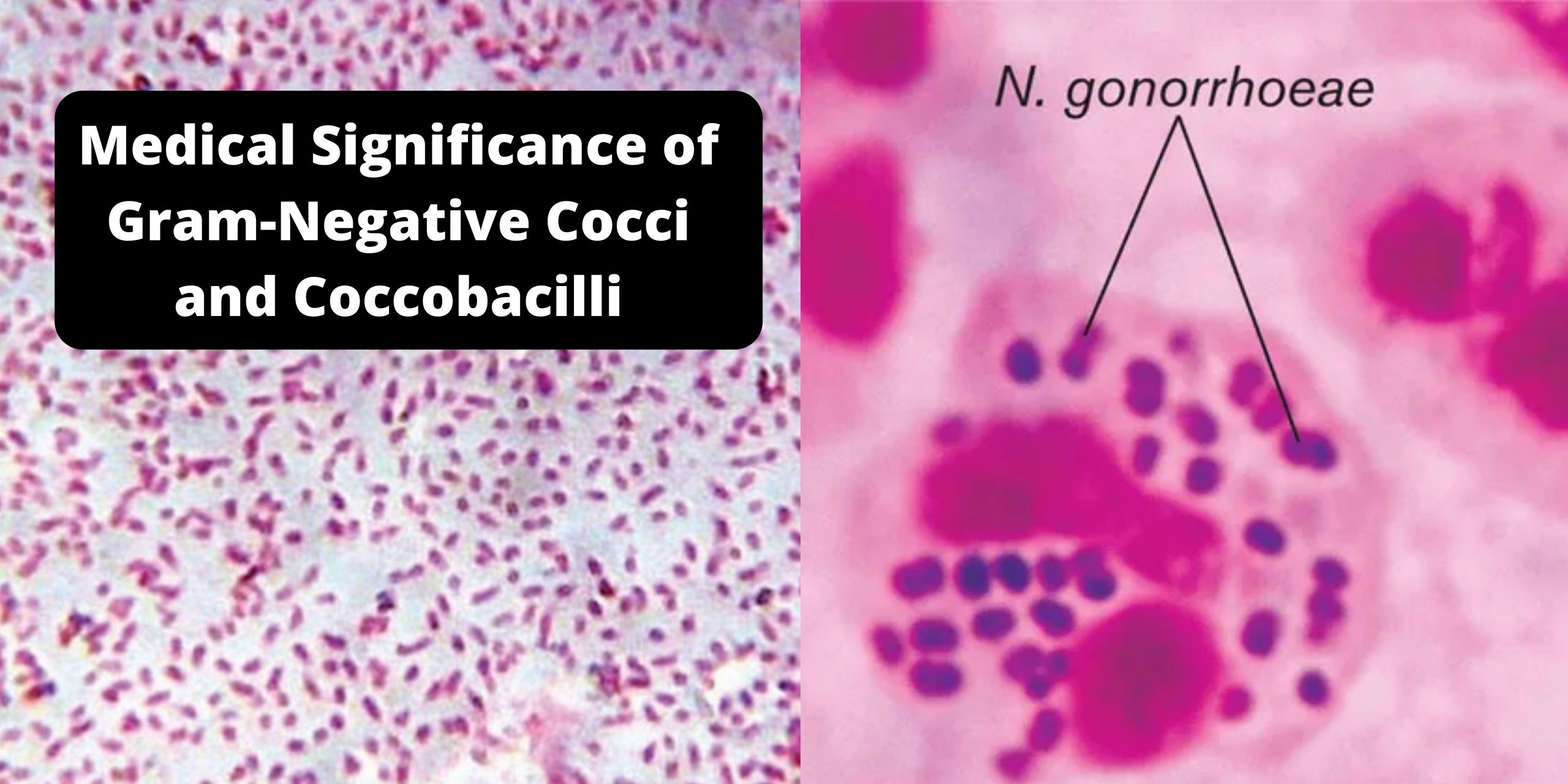 Medical Significance of Gram-Negative Cocci and Coccobacilli