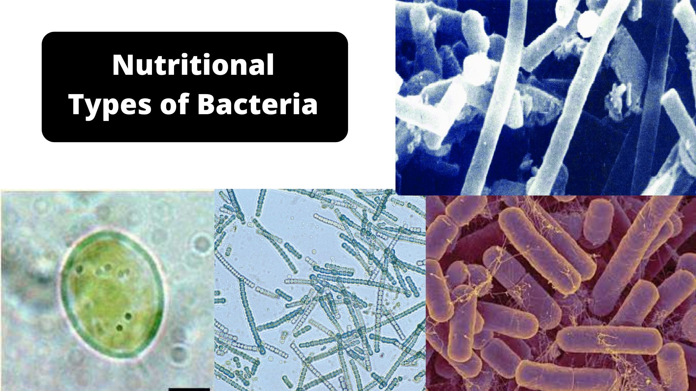 Nutritional types of bacteria - Classification of bacteria based on Nutritional Requirement