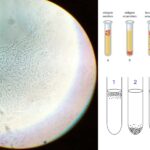 Obligate Anaerobes - Definition, Identification, Mechanism, Uses, Examples