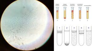 Obligate Anaerobes – Definition, Identification, Mechanism, Uses, Examples