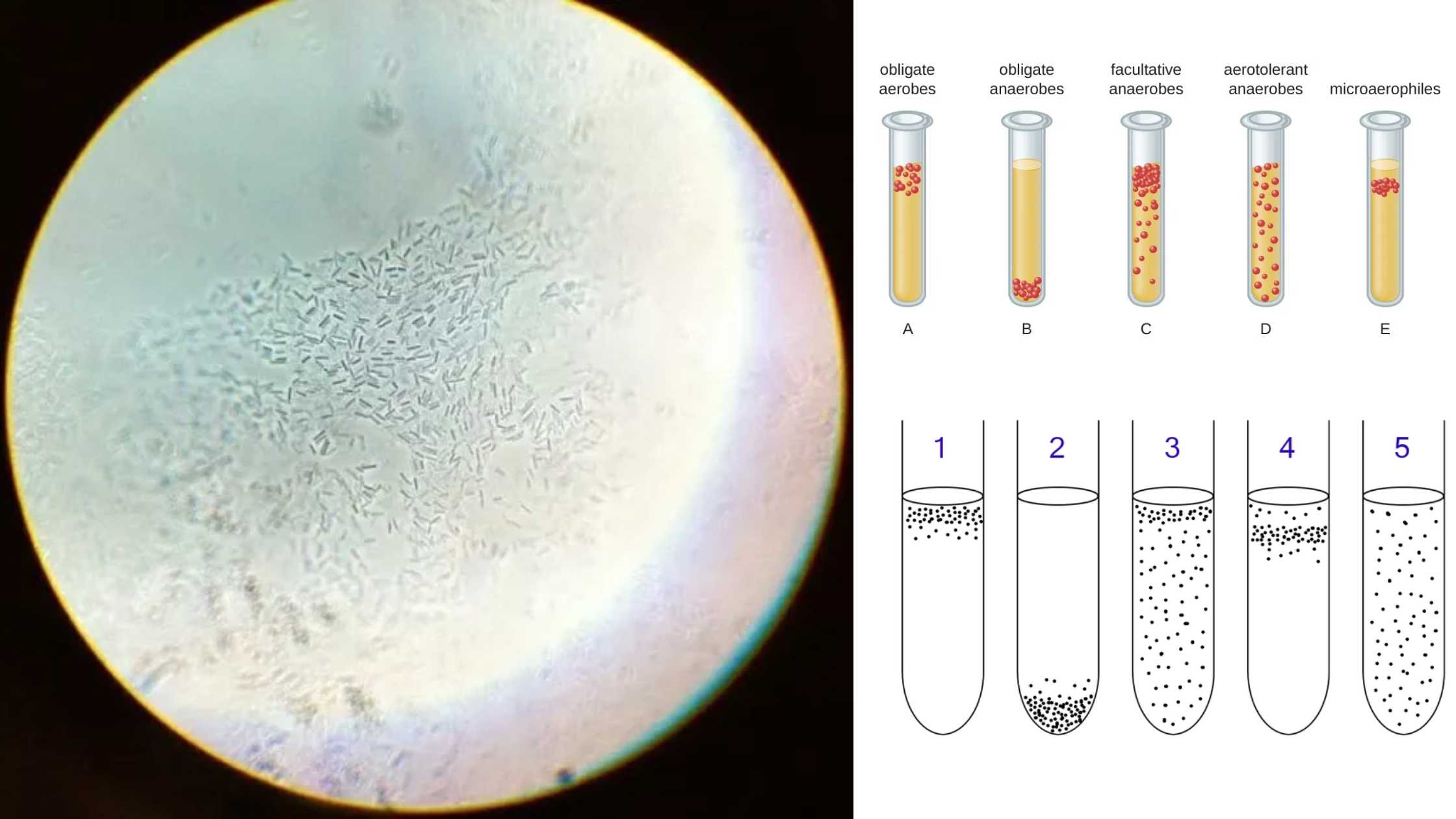 Obligate Anaerobes - Definition, Identification, Mechanism, Uses, Examples