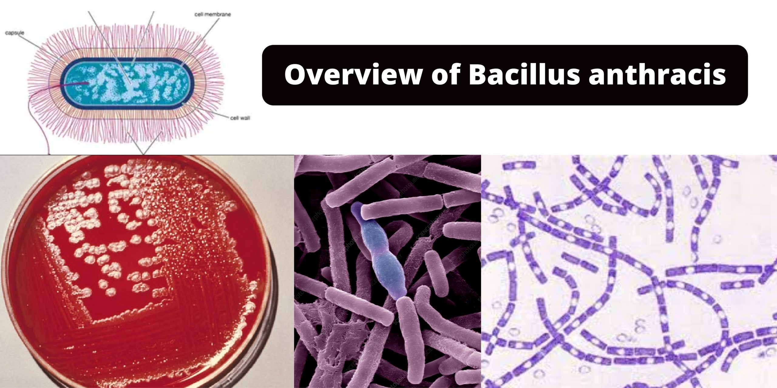 Overview of Bacillus anthracis