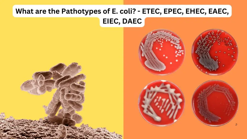 What are the Pathotypes of E. coli? - ETEC, EPEC, EHEC, EAEC, EIEC ...