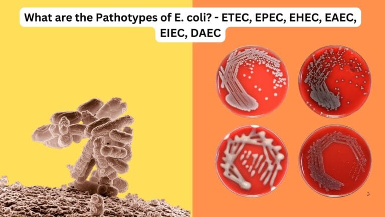What are the Pathotypes of E. coli? - ETEC, EPEC, EHEC, EAEC, EIEC, DAEC