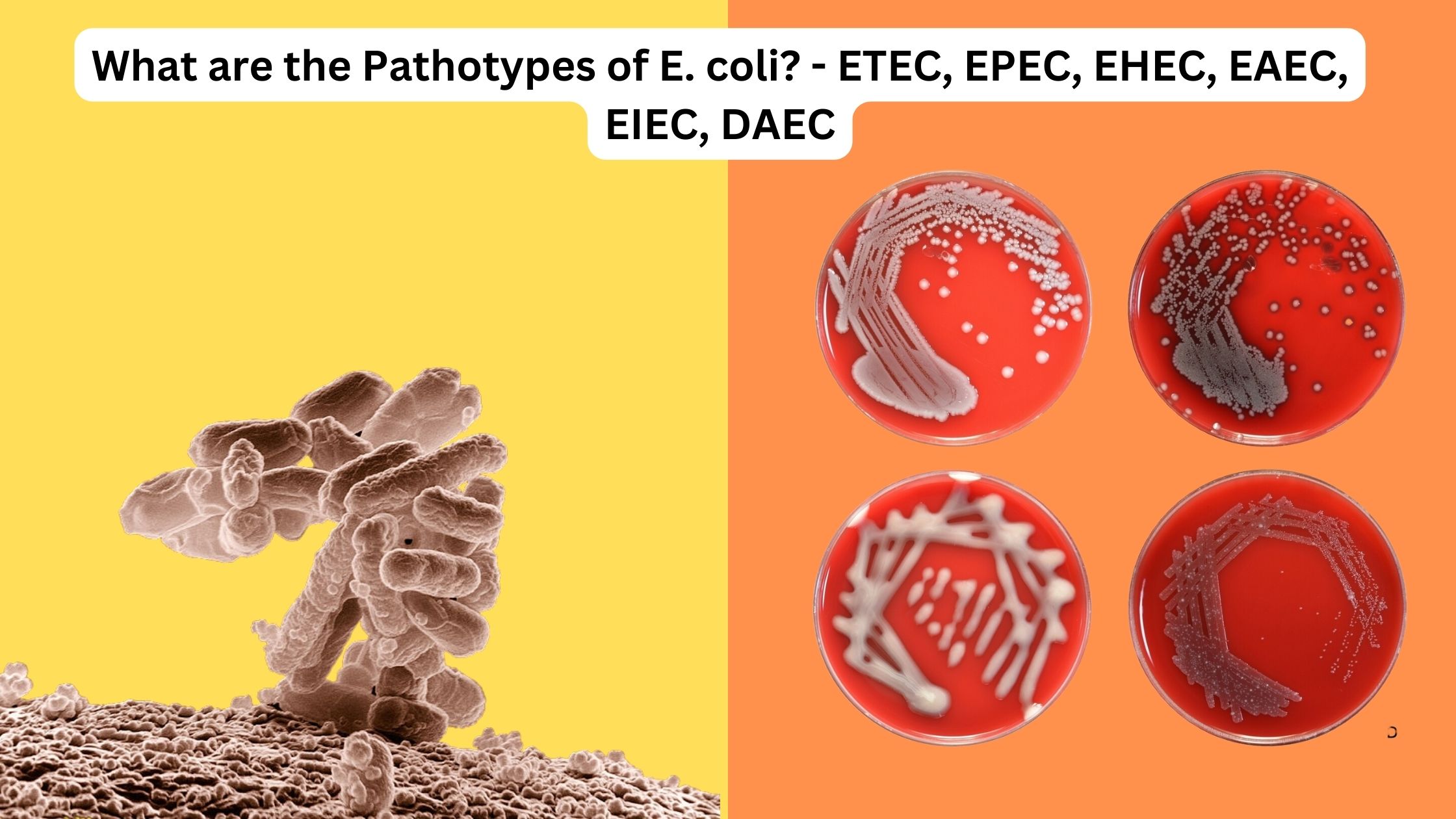 Bacteriology- Microbiology Note