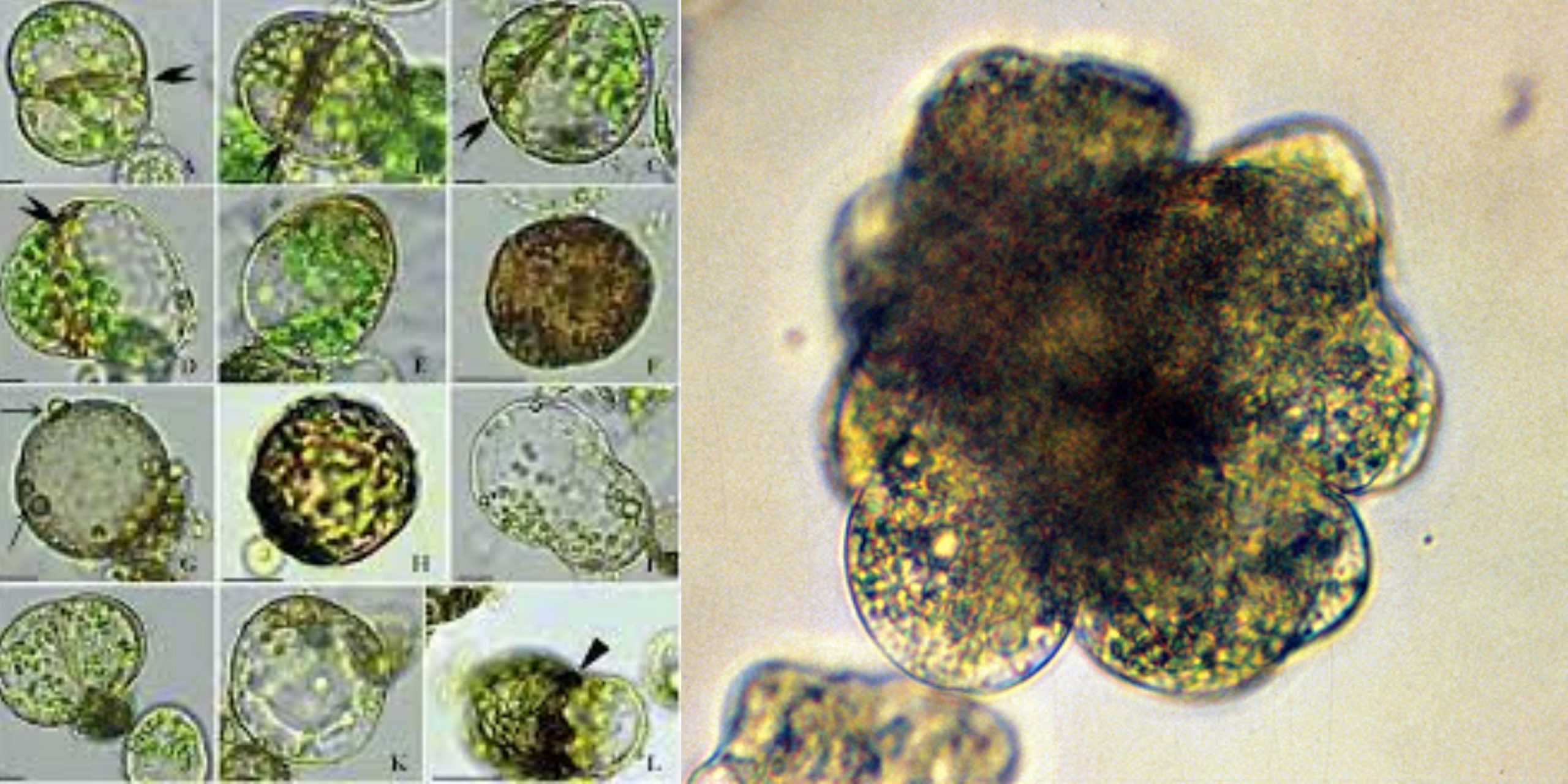 Protoplasts Isolation