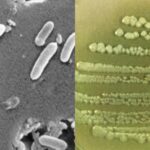 Pseudomonas aeruginosa - Habitat, Diagnosis, Pathogenesis, Treatment