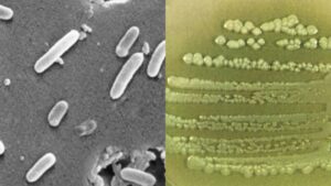 Pseudomonas aeruginosa – Habitat, Diagnosis, Pathogenesis, Treatment