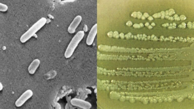 Pseudomonas aeruginosa - Habitat, Diagnosis, Pathogenesis, Treatment