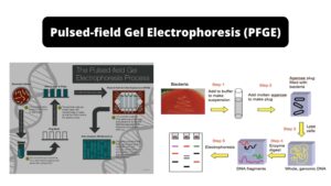 Pulsed-field Gel Electrophoresis (PFGE) – Definition, Types, Steps, Applications