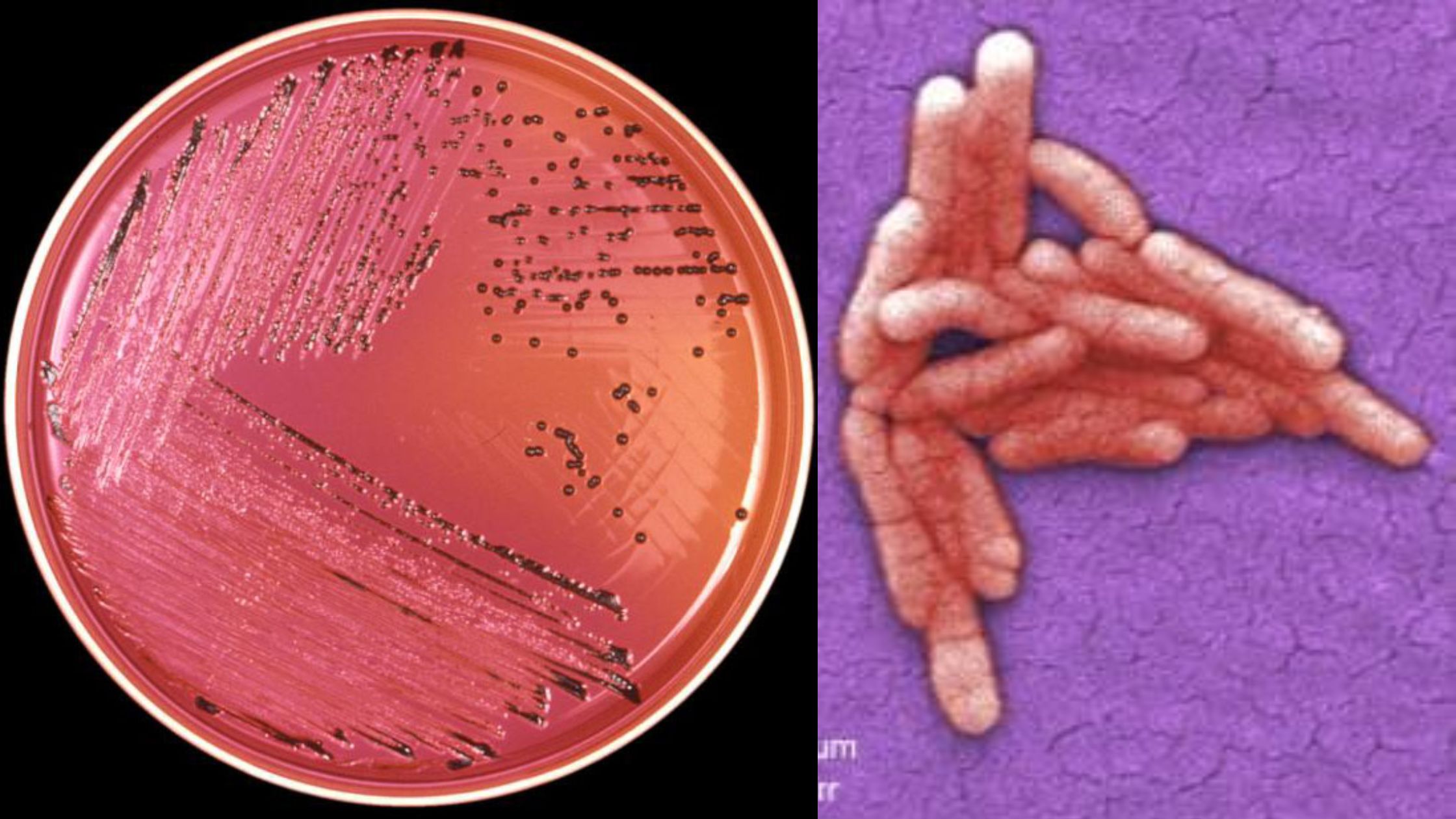 Salmonellosis - Food Infection and Food Poisoning by Salmonella