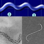 Spirochete - Definition, Morphology, Diseases