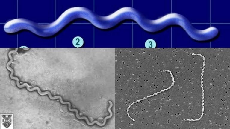 Spirochete - Definition, Morphology, Diseases