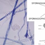 Sporangium - Definition, Characteristics, Structure, Importance