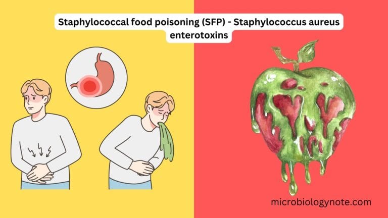 Staphylococcal food poisoning (SFP) - Staphylococcus aureus enterotoxins