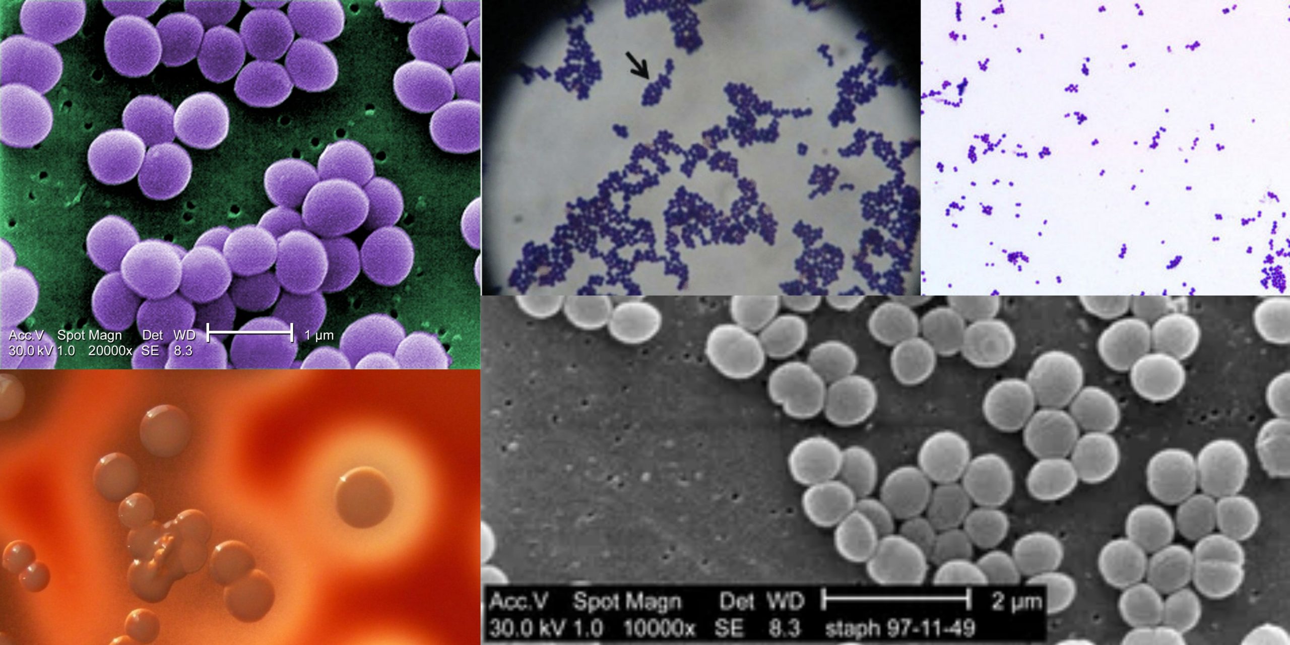 Staphylococcus aureus