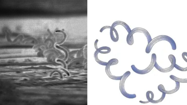 Treponema Pallidum - Definition, Structure, Transmission, Pathogenesis, Treatment