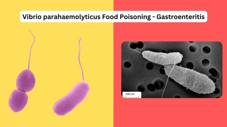 Vibrio parahaemolyticus Food Poisoning - Gastroenteritis