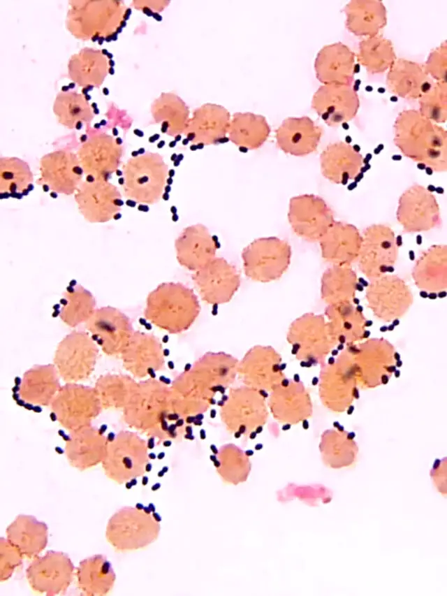 how is streptococcus pneumoniae able to avoid destruction by a phagocyte?