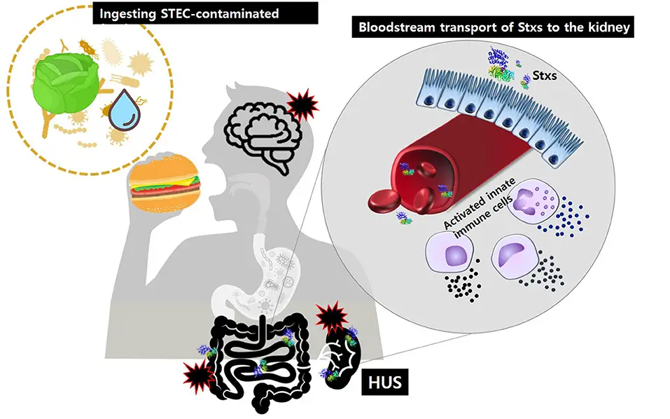 Shiga toxin-producing Escherichia coli (STEC) - Biology Notes Online