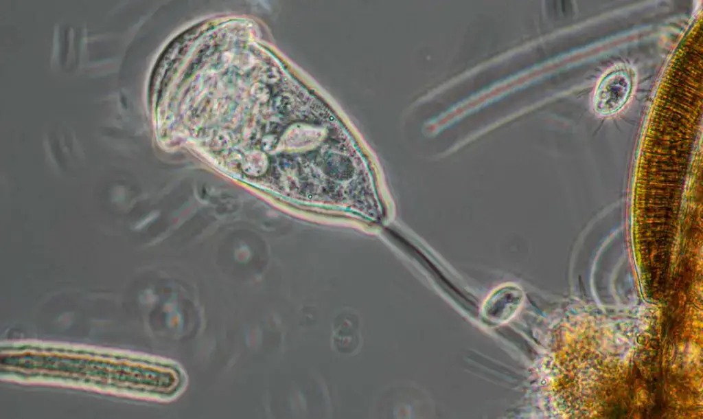 Peritrich ciliate and two smaller ciliates, a diatom and blue green algae photographed with Motic 40X phase contrast objective, no filters. | Image Credit: Robert Berdan