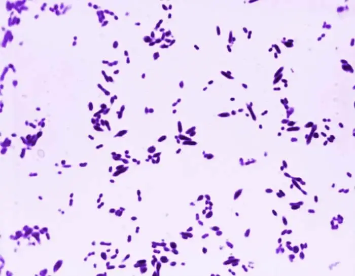 streptococcus pneumoniae under microscope