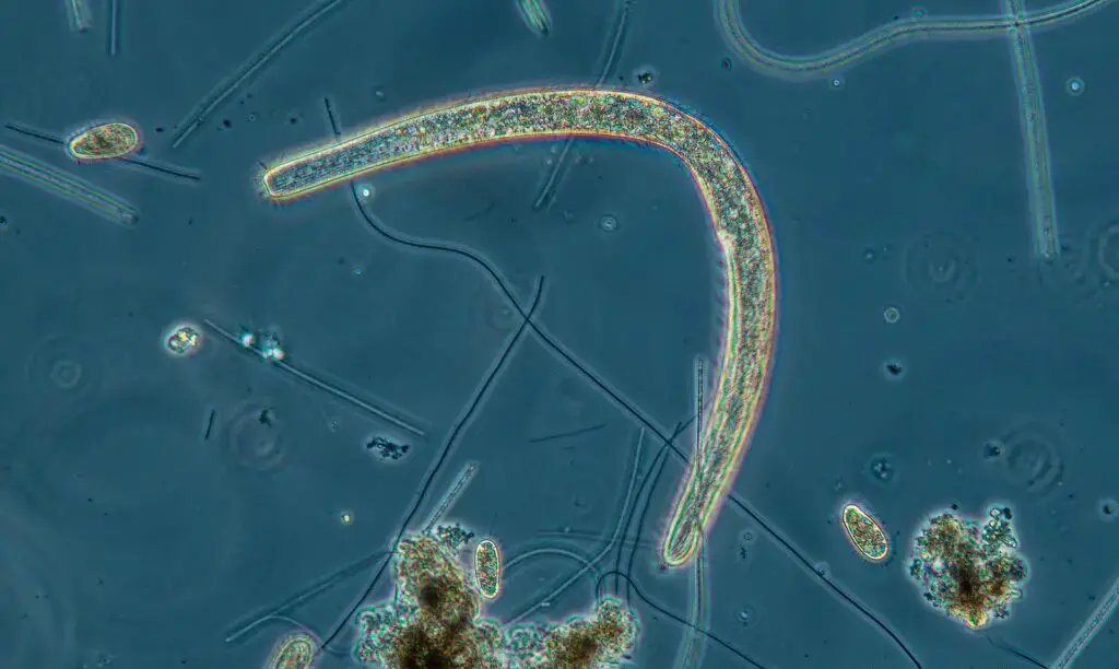 Fast moving ciliate Spirostomum minus photographed using a Motic phase contrast 10X objective and blue filter. | Image Credit: Robert Berdan