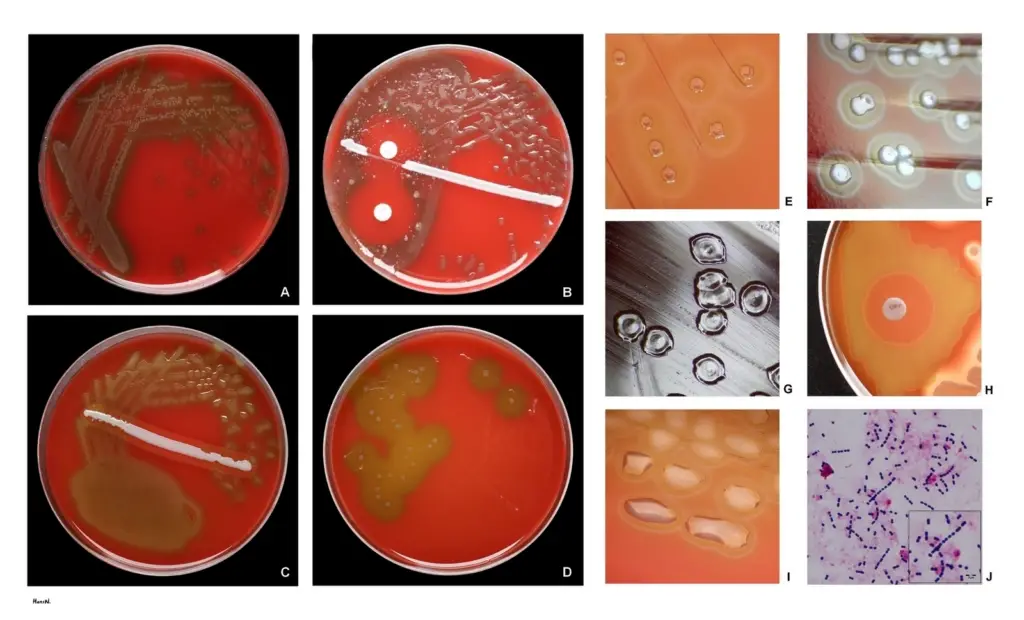 S.pneumoniae growth on blood agar.
