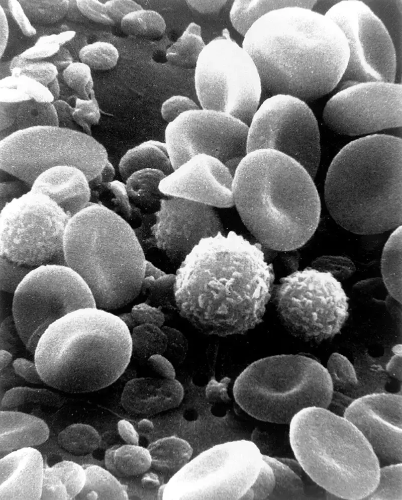 Scanning Electron Microscope (SEM) Images – SEM image of normal circulating human blood. This is an older and noisy micrograph of a common subject for SEM micrographs: red blood cells.