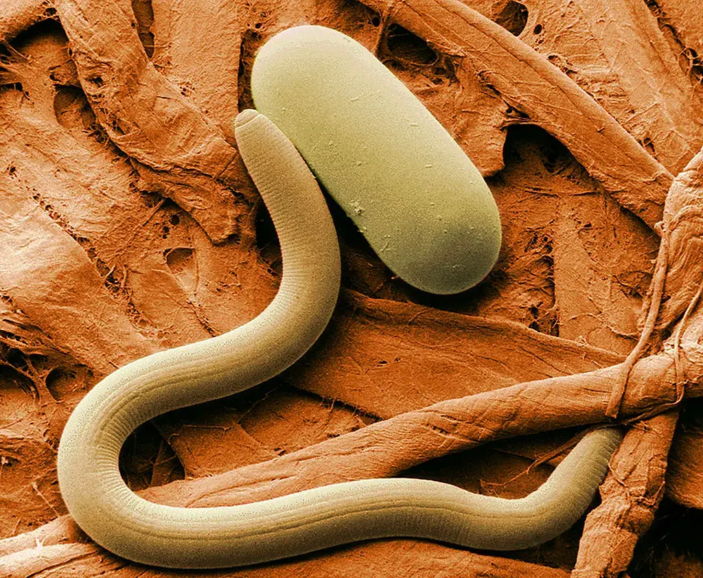 Scanning Electron Microscope (SEM) Images – Colored SEM image of soybean cyst nematode and egg. The artificial coloring makes the image easier for non-specialists to view and understand the structures and surfaces revealed in micrographs.